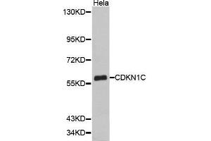 Western Blotting (WB) image for anti-Cyclin-Dependent Kinase Inhibitor 1C (p57, Kip2) (CDKN1C) (AA 1-100) antibody (ABIN6219243) (CDKN1C 抗体  (AA 1-100))