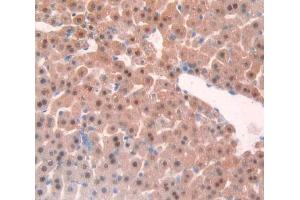 IHC-P analysis of liver tissue, with DAB staining. (TNFRSF1A 抗体  (AA 239-433))