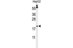 Western blot analysis of PXMP2 (arrow) in HepG2 cell line lysates (35ug/lane) using PXMP2  (PXMP2 抗体  (Middle Region))