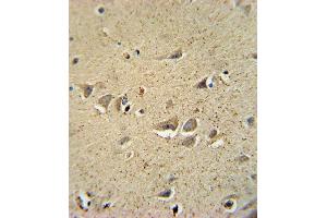Immunohistochemistry (Paraffin-embedded Sections) (IHC (p)) image for anti-Sodium Channel, Voltage-Gated, Type I, beta (SCN1B) (AA 63-90), (N-Term) antibody (ABIN654602)