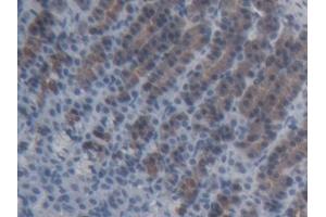 Immunohistochemistry (IHC) image for anti-ATP-Binding Cassette, Sub-Family C (CFTR/MRP), Member 11 (ABCC11) (AA 1127-1366) antibody (ABIN7445732)