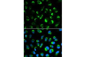 Immunofluorescence analysis of HepG2 cell using SHMT2 antibody. (SHMT2 抗体)