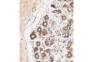 Immunohistochemical analysis of paraffin-embedded human breast tissue using C performed on the Leica® BOND RXm. (ALOXE3 抗体  (AA 223-252))