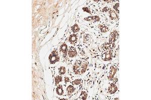 Immunohistochemical analysis of paraffin-embedded human breast tissue using C performed on the Leica® BOND RXm.