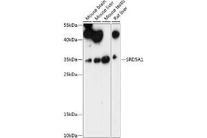 Western blot analysis of extracts of various cell lines, using SRD5 antibody (4787) at 1:1000 dilution. (SRD5A1 抗体  (AA 100-200))