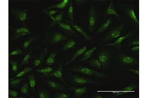 Immunofluorescence of purified MaxPab antibody to CDC6 on HeLa cell. (CDC6 抗体  (AA 1-560))