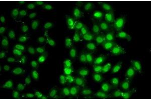 Immunofluorescence analysis of U2OS cells using PSMD8 Polyclonal Antibody (PSMD8 抗体)