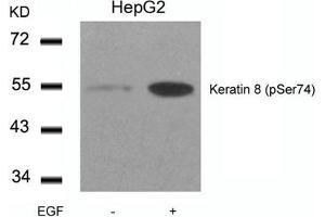 Western blot analysis of extracts from HepG2 cells untreated or treated with EGF using Keratin 8(Phospho-Ser74) Antibody. (KRT8 抗体  (pSer74))