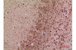 Immunohistochemistry (IHC) image for anti-Mannose Receptor, C Type 2 (MRC2) (Internal Region) antibody (ABIN6284975)
