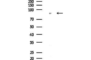 Western blot analysis of lysates from HepG2 cells, using SLC27 Antibody at 1/1000 dilution.