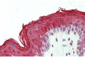 Immunohistochemistry (IHC) image for anti-DnaJ (Hsp40) Homolog, Subfamily B, Member 1 (DNAJB1) (AA 74-123) antibody (ABIN6754951)