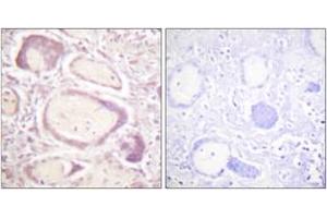 Immunohistochemistry analysis of paraffin-embedded human placenta, using Cyclin B1 (Phospho-Ser147) Antibody. (Cyclin B1 抗体  (pSer147))
