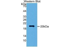 Western Blotting (WB) image for anti-Visinin-Like 1 (VSNL1) (AA 39-184) antibody (ABIN1872291) (VSNL1 抗体  (AA 39-184))