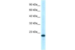 Western Blotting (WB) image for anti-Tumor Necrosis Factor Receptor Superfamily, Member 18 (TNFRSF18) antibody (ABIN2463662) (TNFRSF18 抗体)