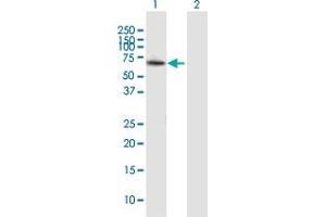 Western Blotting (WB) image for anti-Zinc Finger, MYND-Type Containing 11 (ZMYND11) (AA 1-508) antibody (ABIN2566057)