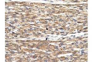 PNPLA3 antibody was used for immunohistochemistry at a concentration of 4-8 ug/ml to stain Myocardial cells (arrows) in Human Heart. (PNPLA3 抗体  (C-Term))