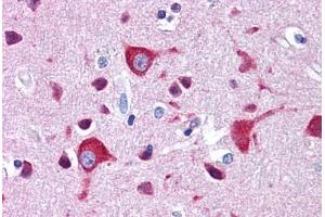 Human Brain, Cortex: Formalin-Fixed, Paraffin-Embedded (FFPE)