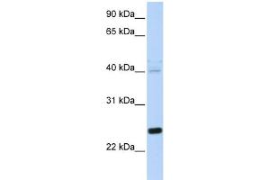 WB Suggested Anti-HSPB8 Antibody Titration: 0. (HSPB8 抗体  (N-Term))