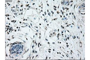 Image no. 2 for anti-Nuclear Receptor Binding Protein 1 (NRBP1) antibody (ABIN1499825) (NRBP1 抗体)