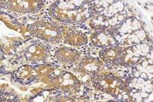 Immunohistochemistry analysis of paraffin-embedded rat colon using CD13(ABIN7072989) at dilution of 1:1000. (CD13 抗体)
