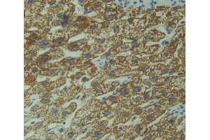 Used in DAB staining on fromalin fixed paraffin- embedded Kidney tissue (DIXDC1 抗体  (AA 485-683))