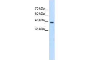 Western Blotting (WB) image for anti-Phosphate Cytidylyltransferase 2, Ethanolamine (PCYT2) antibody (ABIN2462716) (PCYT2 抗体)