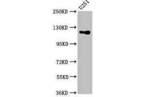 Western Blot Positive WB detected in: U251 whole cell lysate All lanes: GUCY2D antibody at 5. (GUCY2D 抗体  (AA 362-462))