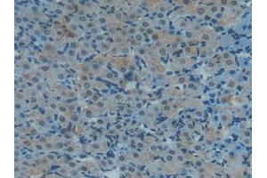 Used in DAB staining on fromalin fixed paraffin- embedded kidney tissue (TXN 抗体  (AA 1-105))