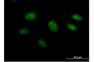Immunofluorescence of purified MaxPab antibody to ARL3 on HeLa cell. (ARL3 抗体  (AA 1-182))