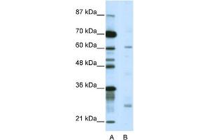 WB Suggested Anti-NR1I2 Antibody Titration:  5. (NR1I2 抗体  (C-Term))