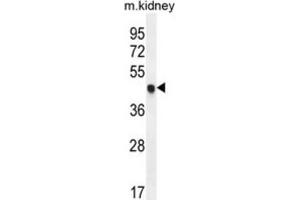 Western Blotting (WB) image for anti-Cyclin-Dependent Kinase Inhibitor 1C (p57, Kip2) (CDKN1C) antibody (ABIN2995933) (CDKN1C 抗体)