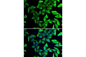 Immunofluorescence analysis of U2OS cells using VSNL1/VILIP-1 antibody (ABIN3016717, ABIN3016718, ABIN3016719 and ABIN6219826). (VSNL1 抗体  (AA 1-191))
