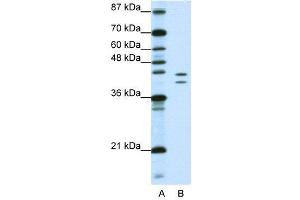 WB Suggested Anti-HNRPD  Antibody Titration: 1. (HNRNPD/AUF1 抗体  (N-Term))