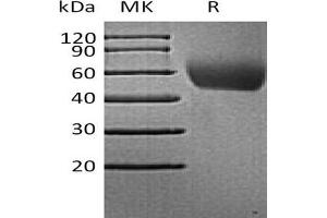 Western Blotting (WB) image for Poliovirus Receptor (PVR) protein (His tag) (ABIN7320997)