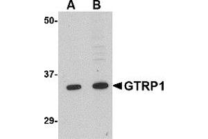 Western Blotting (WB) image for anti-Growth Hormone Regulated TBC Protein 1 (GRTP1) (N-Term) antibody (ABIN1031398) (GRTP1 抗体  (N-Term))