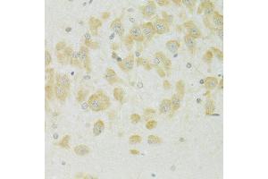 Immunohistochemistry of paraffin-embedded rat brain using SLC37A4 antibody (ABIN6292412) at dilution of 1:100 (40x lens). (SLC37A4 抗体)