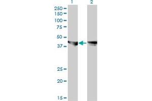 Western Blot analysis of MAPK3 expression in transfected 293T cell line by MAPK3 monoclonal antibody (M01), clone 3C9. (ERK1 抗体  (AA 279-379))