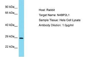 Host: Rabbit Target Name: N4BP2L1 Sample Type: Hela Whole Cell lysates Antibody Dilution: 1. (N4BP2L1 抗体  (N-Term))