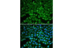 Immunofluorescence analysis of A549 cells using GSS antibody (ABIN6290429). (Glutathione Synthetase 抗体)