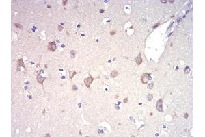 Immunohistochemistry (IHC) image for anti-RAD21 Homolog (RAD21) (AA 287-403) antibody (ABIN5542652)