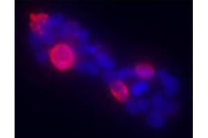 Anti-Gli-1 Antibody - Immunofluorescence. (GLI1 抗体  (AA 805-820))
