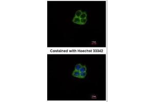 ICC/IF Image Immunofluorescence analysis of methanol-fixed Hep G2, using mtRNA polymerase, antibody at 1:500 dilution. (POLRMT 抗体  (Center))