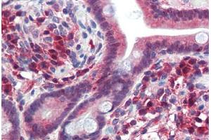 Human Small Intestine (formalin-fixed, paraffin-embedded) stained with TRIM35 antibody ABIN462195 followed by biotinylated goat anti-rabbit IgG secondary antibody ABIN481713, alkaline phosphatase-streptavidin and chromogen. (TRIM35 抗体  (AA 359-408))