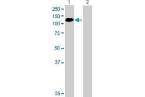 Western Blot analysis of ABR expression in transfected 293T cell line by ABR MaxPab polyclonal antibody. (ABR 抗体  (AA 1-859))