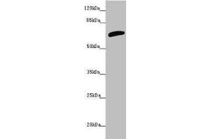 Western blot All lanes: SLC6A12 antibody at 4. (SLC6A12 抗体  (AA 515-614))
