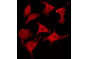 ABIN6274572 staining HeLa by IF/ICC. (Serotonin Receptor 2B 抗体  (Internal Region))