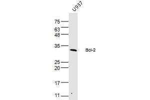 Western Blotting (WB) image for anti-B-Cell CLL/lymphoma 2 (BCL2) (AA 151-239) antibody (ABIN5675264)