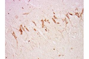 Paraformaldehyde-fixed, paraffin embedded rat brain, Antigen retrieval by boiling in sodium citrate buffer (pH6) for 15min, Block endogenous peroxidase by 3% hydrogen peroxide for 30 minutes, Blocking buffer (normal goat serum) at 37°C for 20min, Antibody incubation with Rabbit Anti-Neurofascin Polyclonal Antibody, Unconjugated  at 1:500 overnight at 4°C, followed by a conjugated secondary and DAB staining. (NFASC 抗体  (AA 501-650))