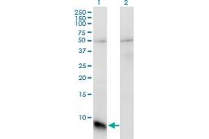 Western Blot analysis of GNGT1 expression in transfected 293T cell line by GNGT1 monoclonal antibody (M01), clone 1F8. (GNGT1 抗体  (AA 1-74))