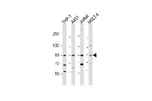 All lanes : Anti-IL12RB2 Antibody (C-term) at 1:2000 dilution Lane 1: THP-1 whole cell lysate Lane 2: A431 whole cell lysate Lane 3: Jurkat whole cell lysate Lane 4: MOLT-4 whole cell lysate Lysates/proteins at 20 μg per lane. (IL12_2 (AA 756-783), (C-Term) 抗体)